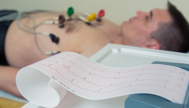 Ein EKG zeichnet Herzaktivität und Herzrhythmus auf.