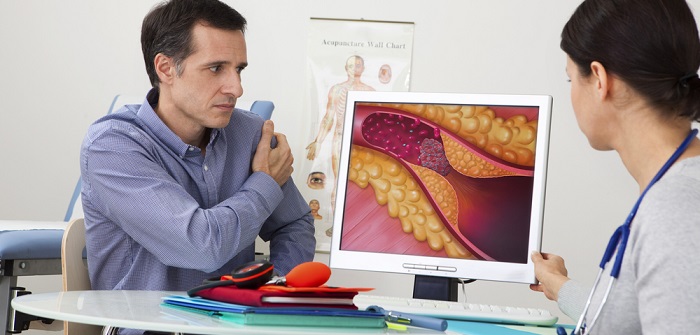 Arteriosklerose: Ursachen, Symptome und Behandlung ( Foto: Shutterstock-Image Point Fr )