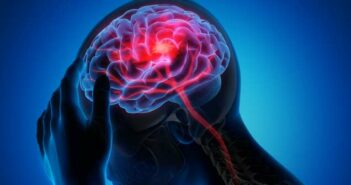 Unbemerkter Schlaganfall: Anzeichen der stummen Gefahr für das Gehirn ( Foto: Shutterstock - peterschreiber.media)