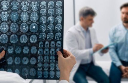 Junge Menschen zunehmend von Schlaganfällen betroffen: Neue (Foto: AdobeStock 593334022 Peakstock)